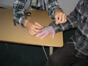 Student demonstration of fishhook removal